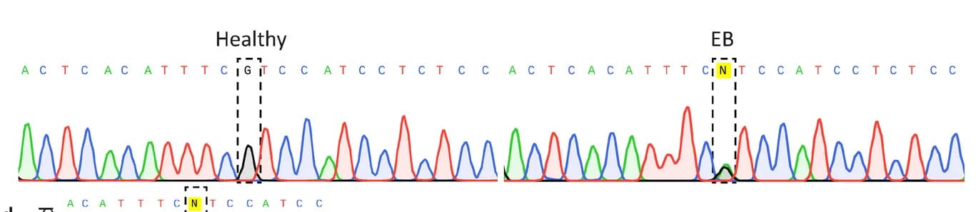 Open access visualization of Line Plot, Sanger Sequencing, Chromatograms, Heterozygous Variant, RDEB