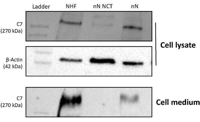 Open access visualization of Gel, Type VII Collagen, Western Blots, Cell Lysate, Cell Medium