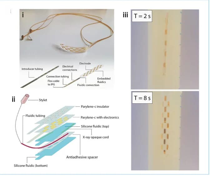 Open access visualization of Illustration, Photo, Spinal Cord, Stimulating Devices, Shape Actuation