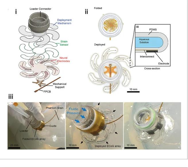 Open access visualization of Illustration, Workflow, Photo, ECoG Array, Pressure-driven Actuation