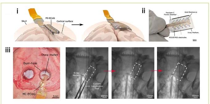 Open access visualization of Illustration, Workflow, Photo, ECoG Arrays, Fluidic Actuation