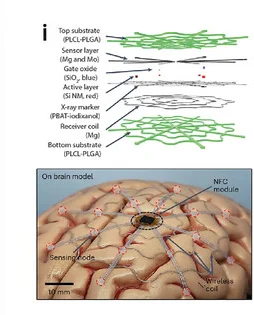 Open access visualization of Illustration, ECoG Electrode, Biodegradable, Shape Memory Polymers, X-ray Marker