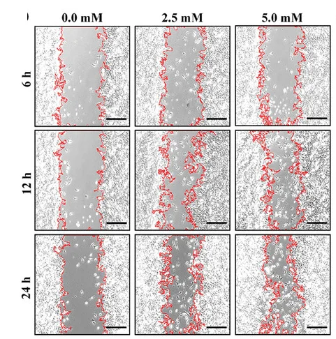 Open access visualization of Microscopy, DLC-VEGF, HUVECs Migration, Scratch Assay, ImageJ Software
