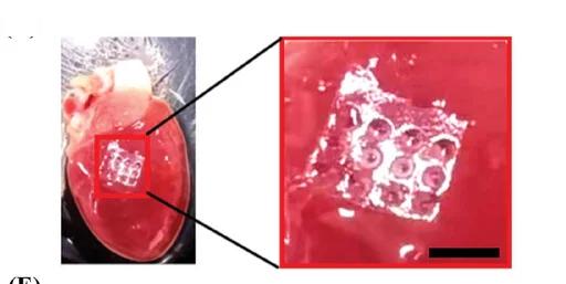 Open access visualization of Photo, Microscopy, MN Patch, Rat Heart