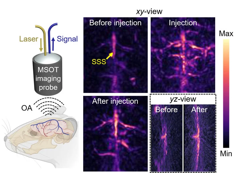 Open access visualization of Microscopy, Illustration, 3D MSOT Imaging, Brain Vasculature, UCNP-COF Particles