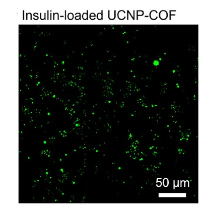 Open access visualization of Microscopy, Fluorescence Microscopy, FITC-labeled Insulin, UCNP-COF Particles