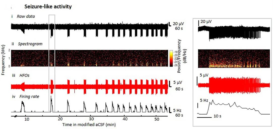 Open access visualization of Line Plot, Spectrogram, Electrophysiological Activity, aCSF, Raw Data