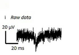 Open access visualization of Line Plot, Ictal-like Discharge, Raw Data, Spectrogram, HFOs
