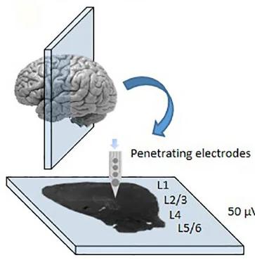 Open access visualization of Illustration, Workflow, Brain Slice, Shanks