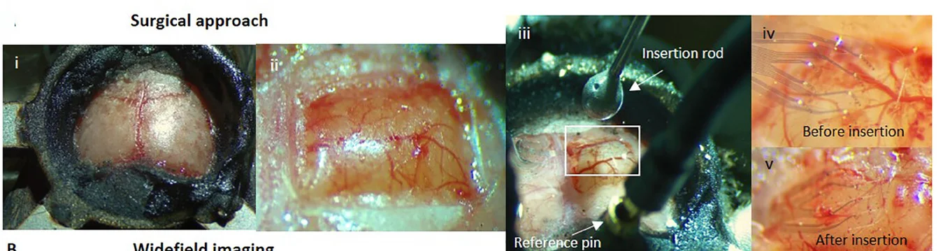 Open access visualization of Microscopy, Photo, Surgical Approach, Mouse Head, Craniotomy