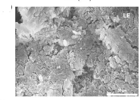 Open access visualization of Microscopy, Morphology, SEM, Surface Features, LMAs
