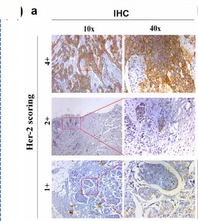 Open access visualization of Microscopy, SERS, HER2, Tissue, Nanotags