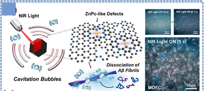 Open access visualization of Illustration, Microscopy, Photoacoustic Dissociation, Alzheimer's Disease, Aβ Aggregate Structure