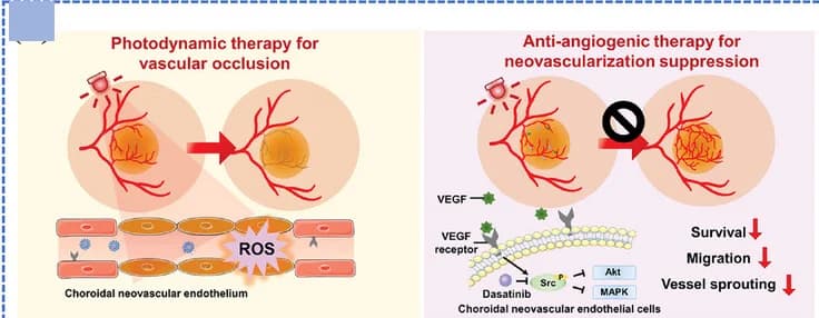Open access visualization of Workflow, Illustration, Nanosystem, Photodynamic Therapy, Age-Related Macular Degeneration