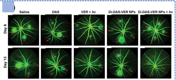 Open access visualization of Microscopy, Fundus Fluorescein Angiography, Mean Fluorescence Intensity, CNV Regions