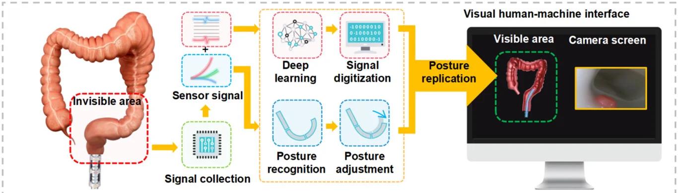 Open access visualization of Workflow, Illustration, Continuum Robot, Digital Twin, 3D Posture Visualization