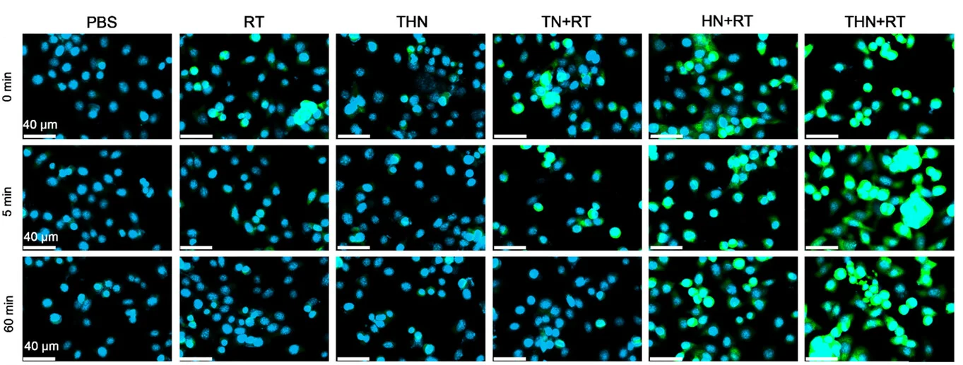 Open access visualization of Microscopy, CLSM Images, OH, Green Fluorescence, 4T1 Cells