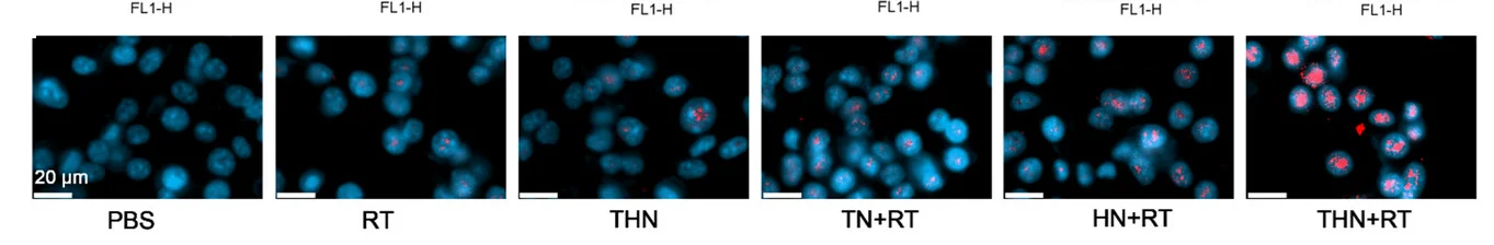 Open access visualization of Microscopy, g-H2AX, Red Fluorescence, 4T1 Cells, Treatment