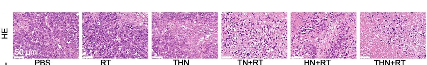 Open access visualization of Microscopy, HE Staining, Tumor Sections