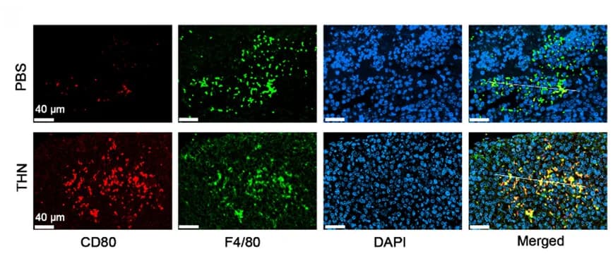 Open access visualization of Microscopy, CD80, F4/80, Immunofluorescence, Tumor Sections