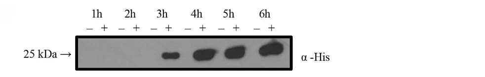 Open access visualization of Gel, Western Blot, Anti-His Antibody, Protein Secretion, Time Course