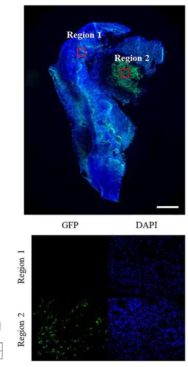 Open access visualization of Microscopy, Bacterial Colonization, Hypoxic Region, Tumor, DAPI Staining