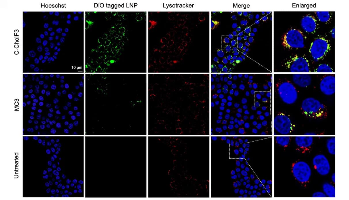 Open access visualization of Microscopy, Confocal Microscopy, Cellular Uptake, Intracellular Trafficking, LNPs
