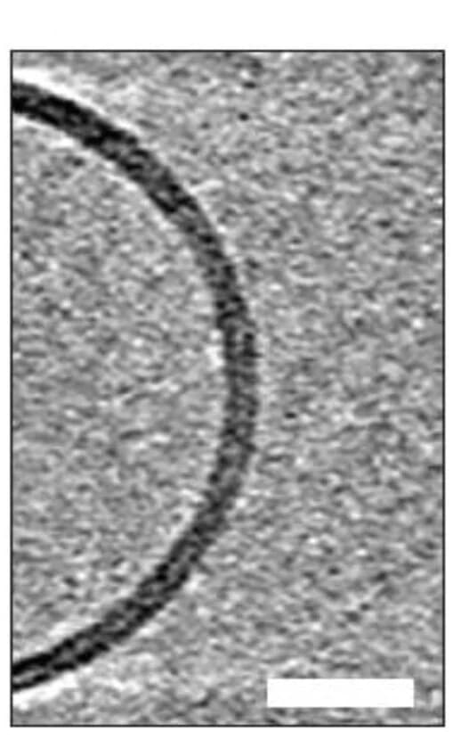 Open access visualization of Microscopy, Large Unilamellar Vesicle, A42 Monomer