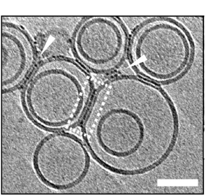 Open access visualization of Microscopy, Abeta42, Liposomes, Protofibrils, Membranes