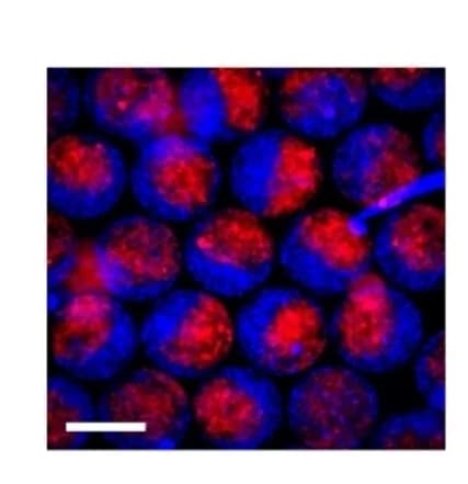 Open access visualization of Microscopy, Hydrogel Microspheres, Colloidosomes, RITC, GOx