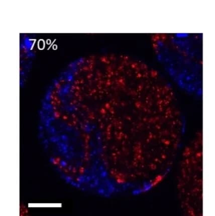 Open access visualization of Microscopy, Hydrogel Microspheres, Colloidosomes, RITC, GOx