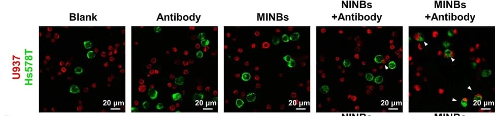 Open access visualization of Microscopy, CLSM Images, Tumor Cells, U937 Cells, Phagocytosis
