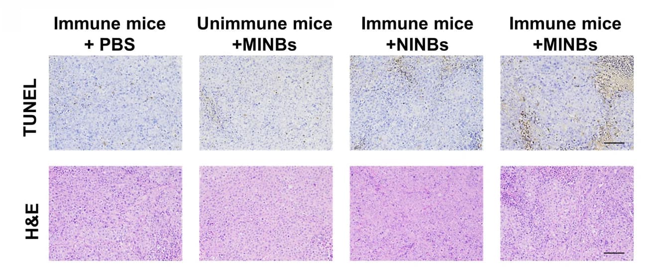 Open access visualization of Microscopy, Photo, Histology, Tumor Tissue, Mice
