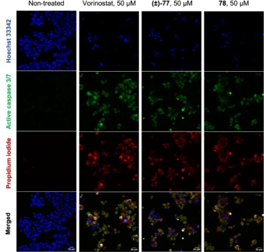 Open access visualization of Microscopy, Fluorescent Microscopy, HepG2 Cells, Vorinostat, Analogs