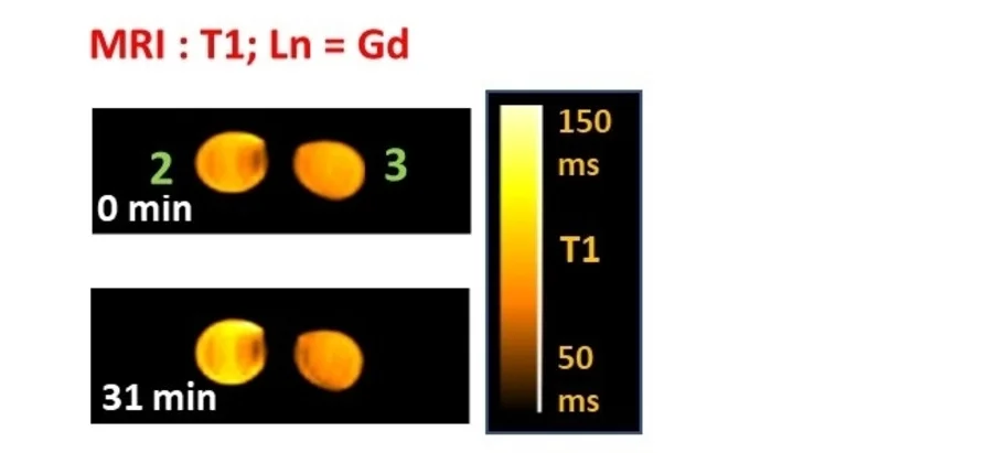 Open access visualization of Microscopy, T1 Maps, Spin-Echo Sequence, Phosphate Buffer, BSA