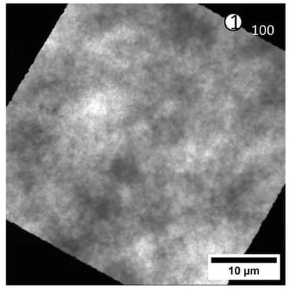 Open access visualization of Microscopy, Transmission Electron Microscopy, TEM, Gel