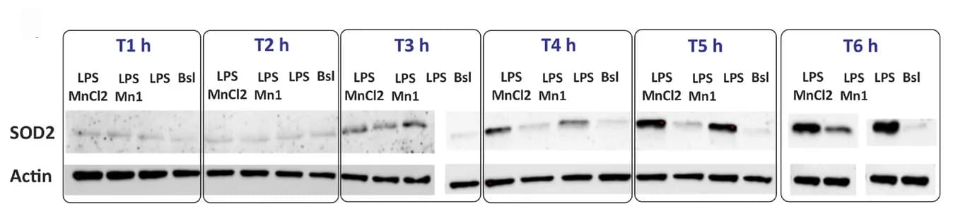Open access visualization of Gel, Western Blot, SOD2, Actin, Normalization