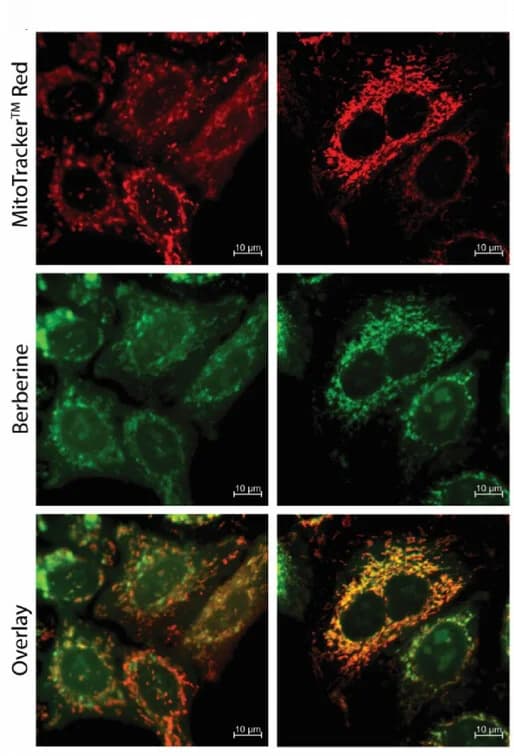 Open access visualization of Microscopy, Confocal Microscopy, HeLa Cells, Berberine, MitoTracker