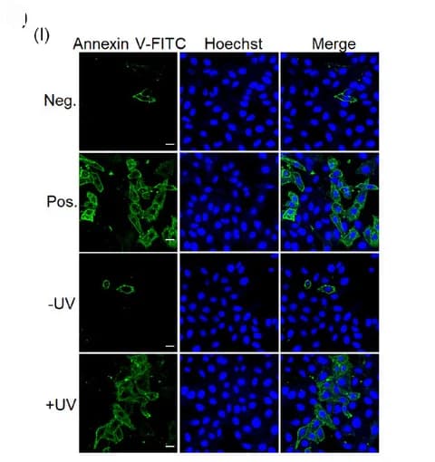Open access visualization of Microscopy, LAC12aGE, Apoptosis, Cas12a Plasmid, HepG2 Cells