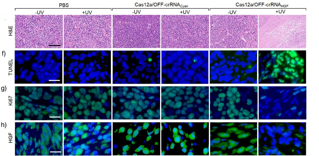 Open access visualization of Microscopy, Microscopy Images, Tumor Tissues, PBS, Cas12a/OFF-crRNACyan