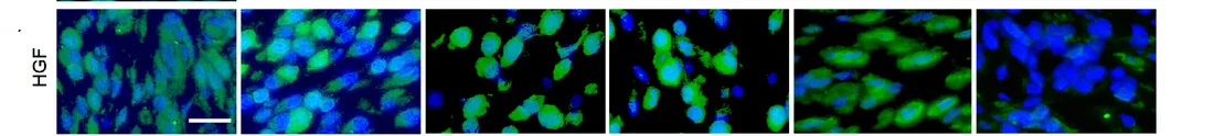 Open access visualization of Microscopy, Immunofluorescence Staining, HGF Protein, Tumor Tissues, Mice