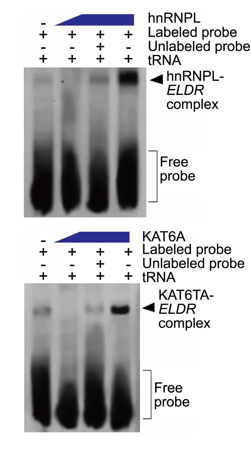 Open access visualization of Gel, hnRNPL, KAT6A, Biotin-labelled key fragment of ELDR transcript, RNA EMSA assay