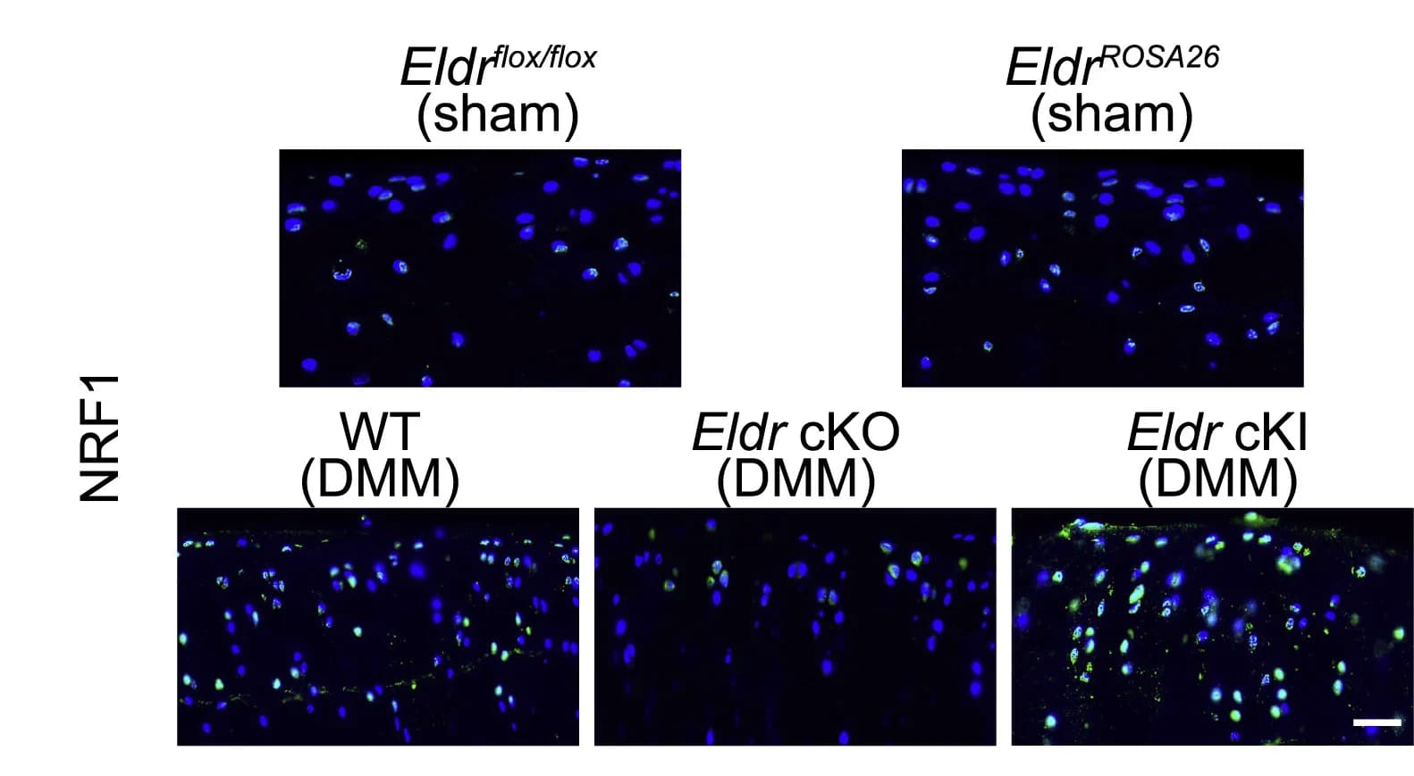 Open access visualization of Microscopy, Immunostaining, NRF1, Cartilage, Mice