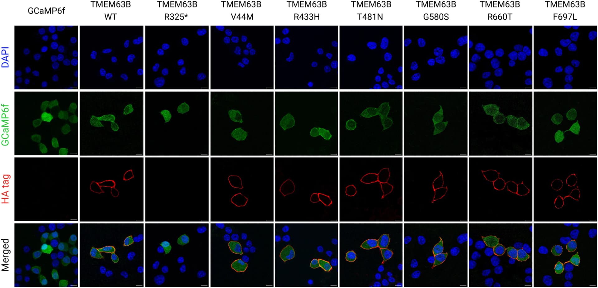 Open access visualization of Microscopy, Confocal Microscopy, Neuro2A Cells, GCaMP6f, TMEM63B