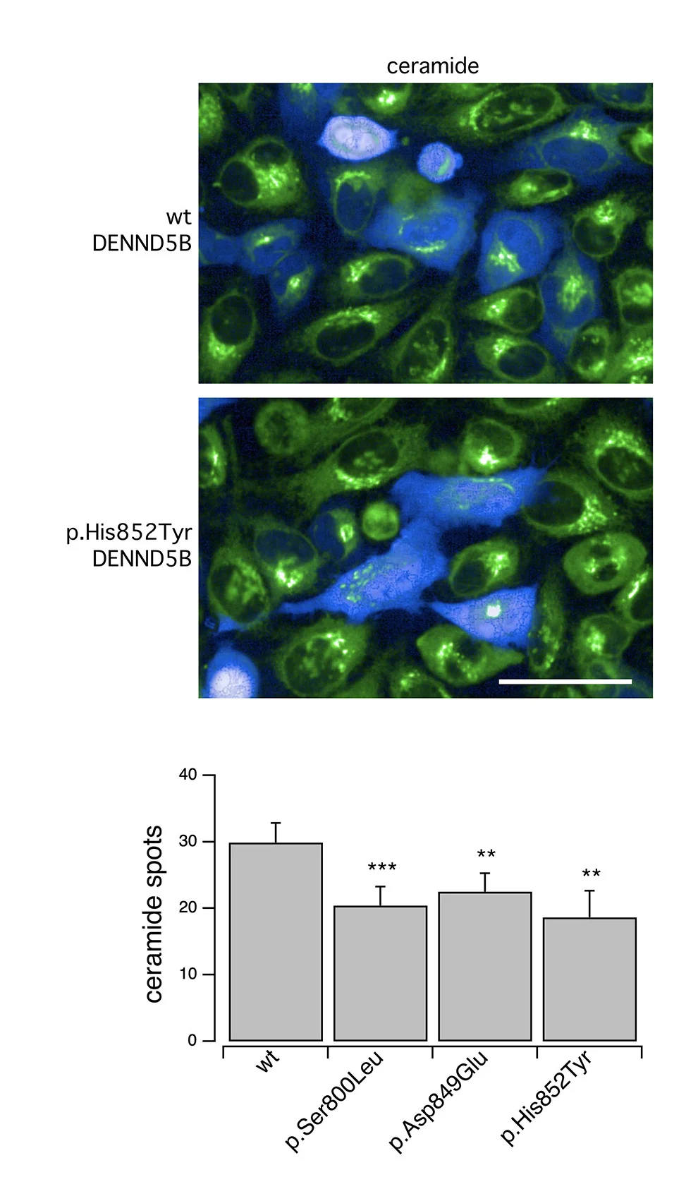 Open access visualization of Bar Plot, Error Bars, Microscopy, Confocal Microscopy, C6-Ceramide Uptake