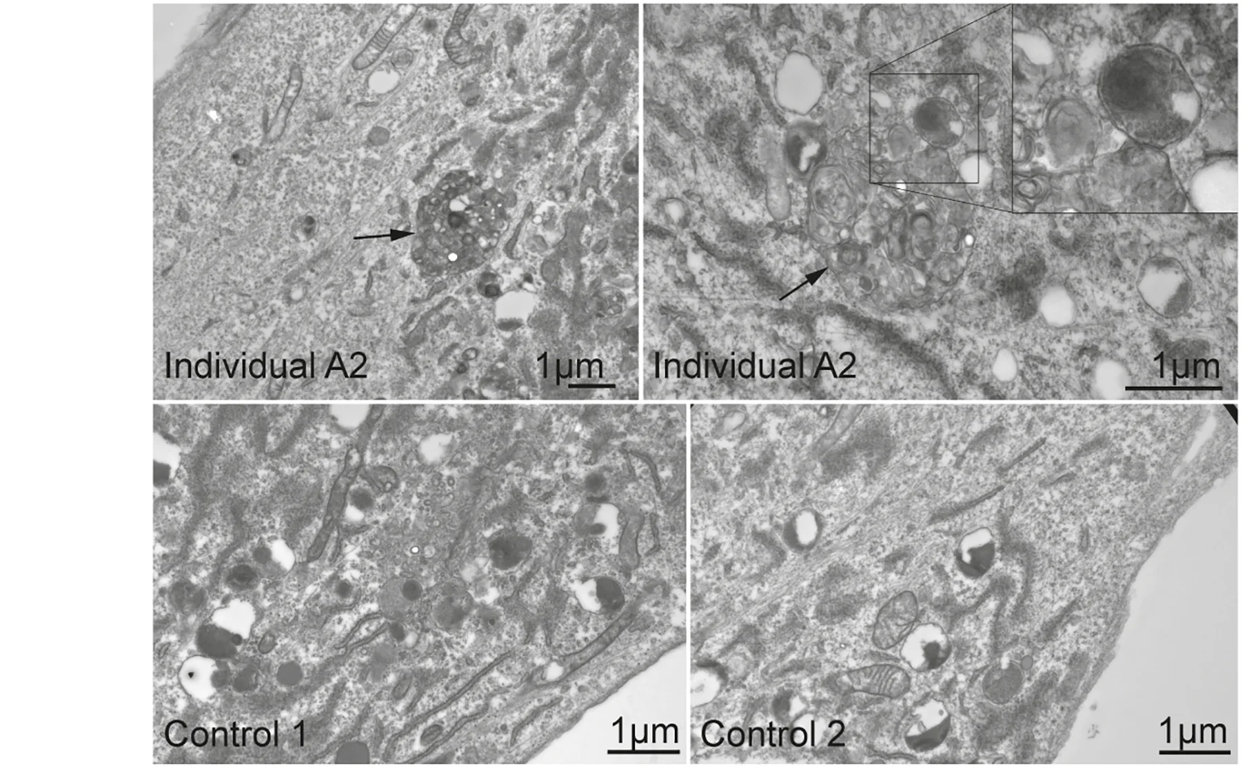 Open access visualization of Microscopy, Fibroblasts, Electron Microscopy, Autolysosomes