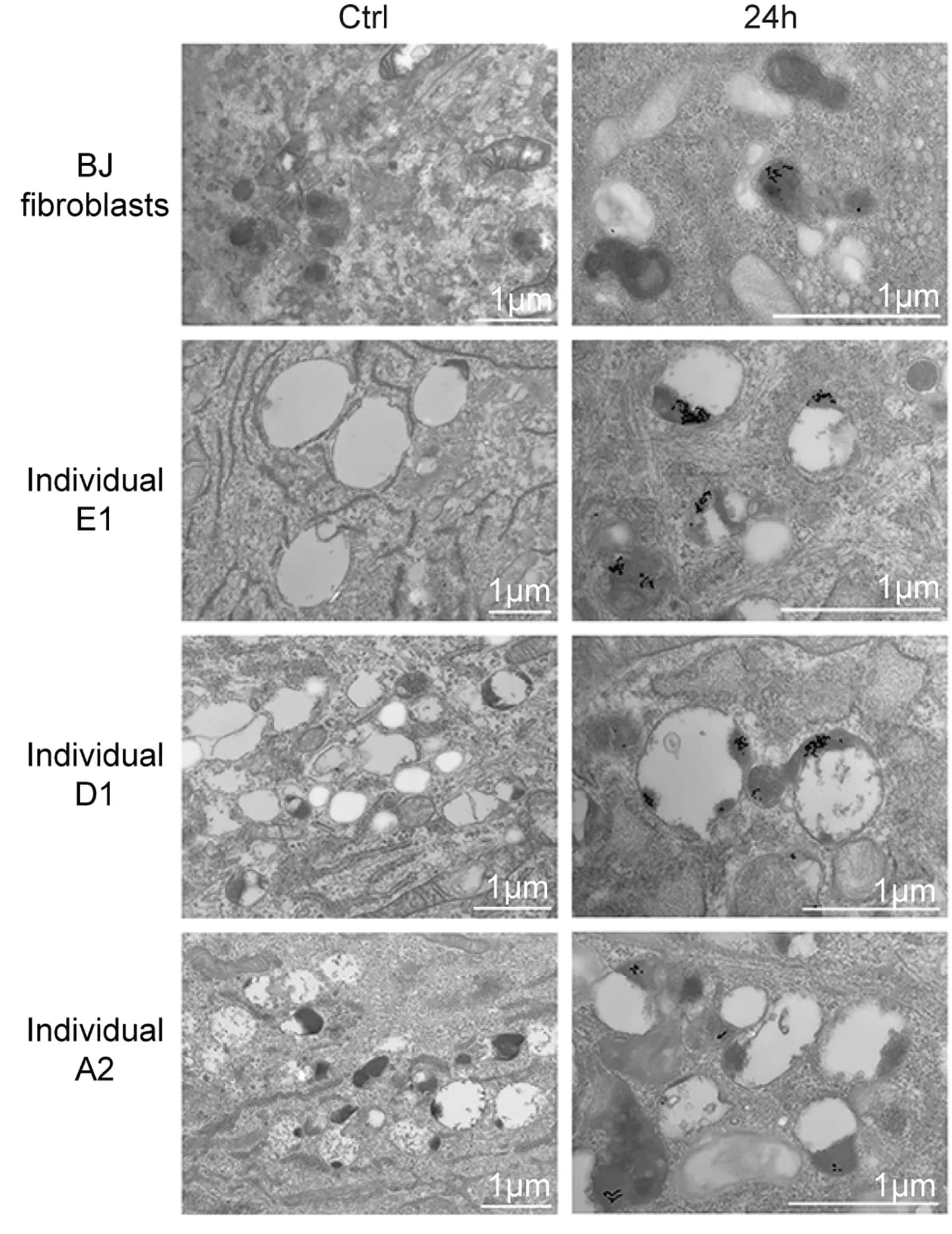 Open access visualization of Microscopy, Fibroblasts, BSA-Gold, Lysosomes, Electron Microscopy
