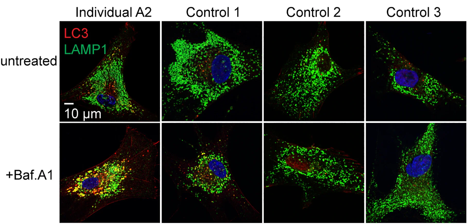 Open access visualization of Microscopy, Fibroblasts, Bafilomycin A1, Immunofluorescence, Confocal Microscopy