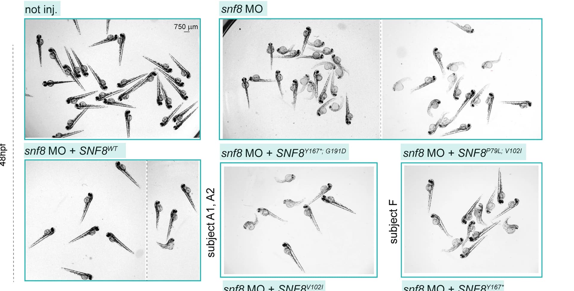 Open access visualization of Microscopy, Bright-Field Pictures, Fish, Zebrafish, mRNA