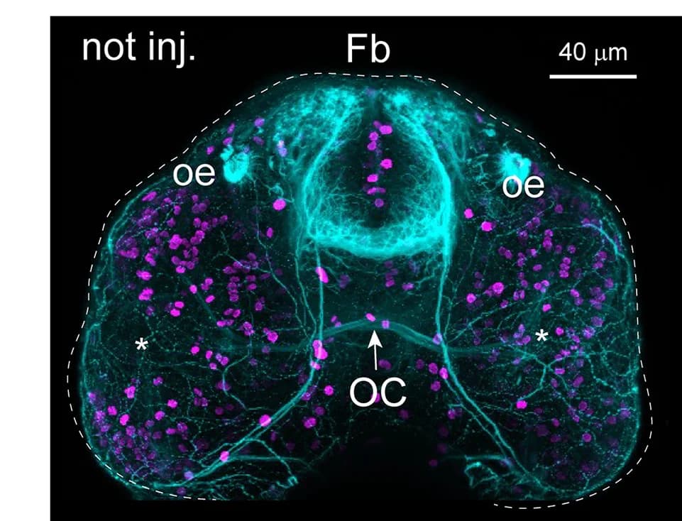 Open access visualization of Microscopy, Confocal Projections, Fish, Antibodies, Acetylated Tubulin